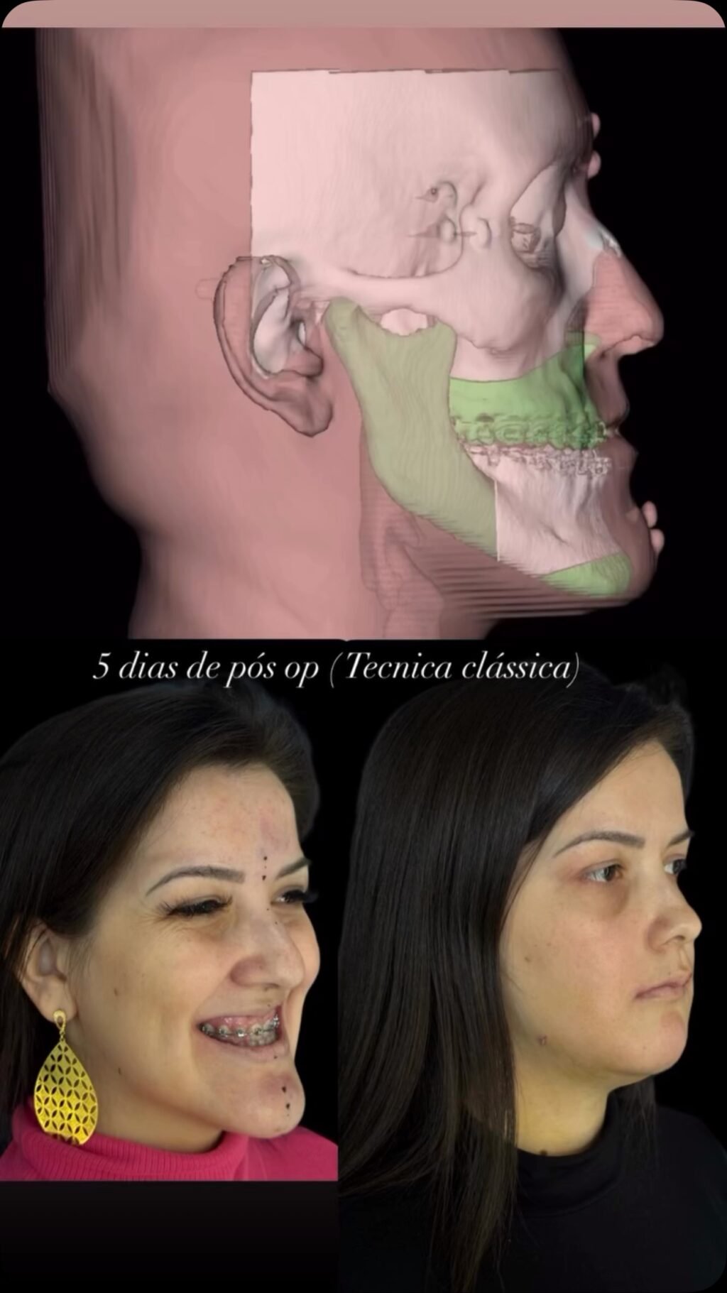 Instagram post from dr.molinari.cirurgia. This post is in position 8.