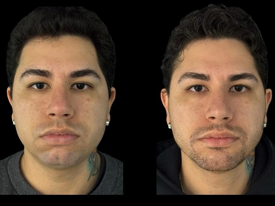 Instagram post from dr.molinari.cirurgia. This post is in position 1.