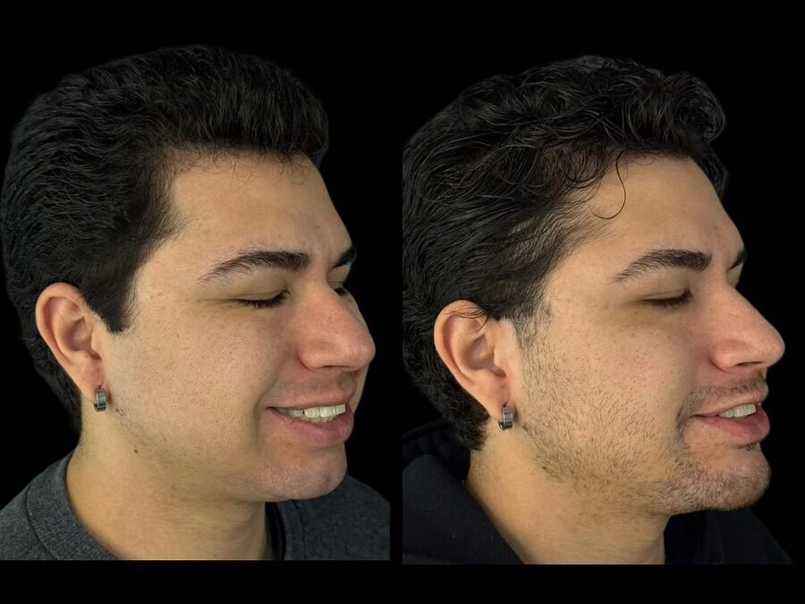 Instagram post from dr.molinari.cirurgia. This post is in position 2.