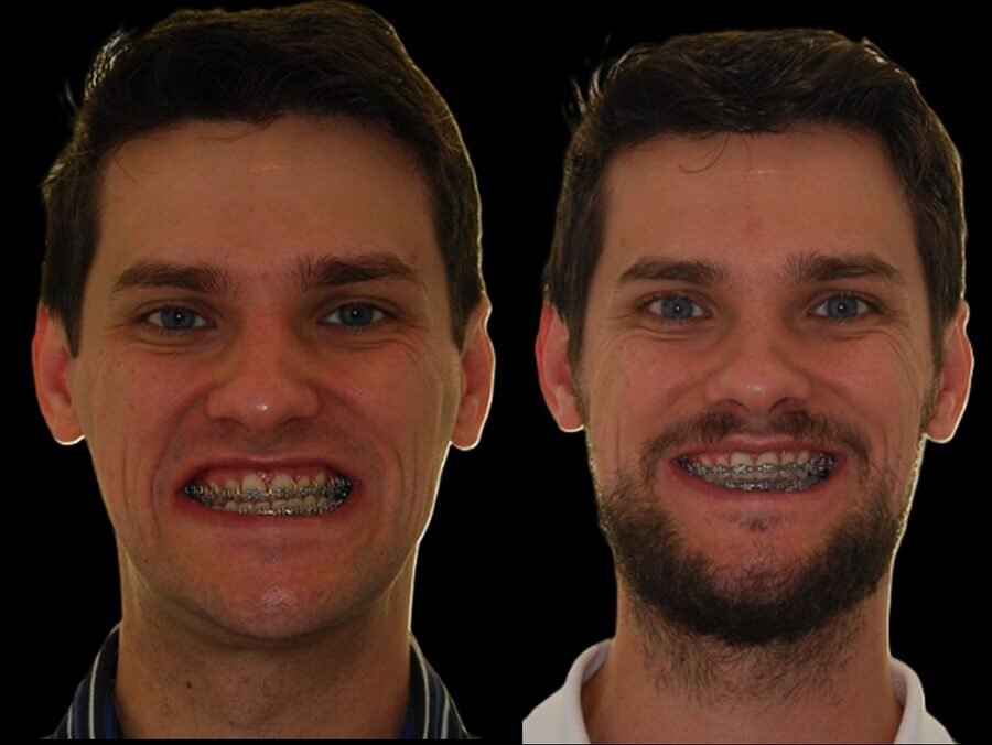 Instagram post from dr.molinari.cirurgia. This post is in position 1.