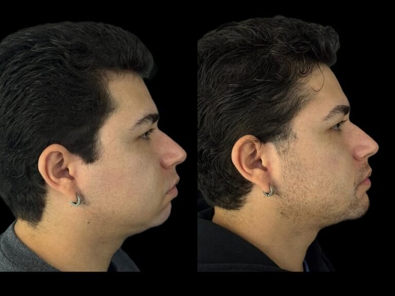 Instagram post from dr.molinari.cirurgia. This post is in position 1.