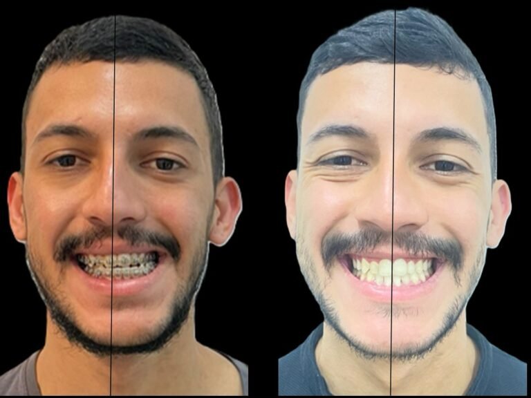 Instagram post from dr.molinari.cirurgia. This post is in position 5.