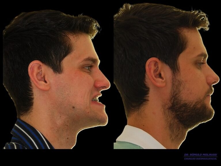 Instagram post from dr.molinari.cirurgia. This post is in position 4.