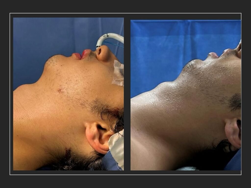 Instagram post from dr.molinari.cirurgia. This post is in position 2.