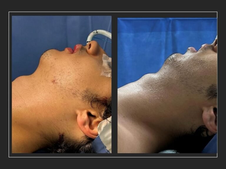 Instagram post from dr.molinari.cirurgia. This post is in position 3.