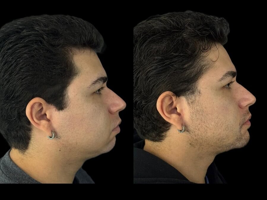 Instagram post from dr.molinari.cirurgia. This post is in position 0.